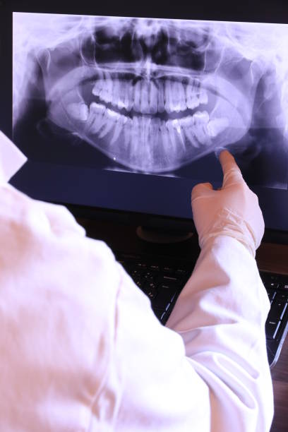 Best Broken Tooth Emergency  in Blountville, TN